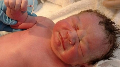 Imagem de recém-nascido segurando DIU faz sucesso nas redes