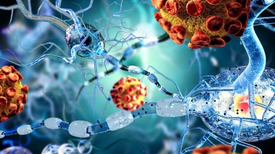 Covid-19: estudo comprova que vírus é capaz de invadir cérebro