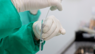 Novo coronavírus: Saúde inicia testes rápidos em Marília