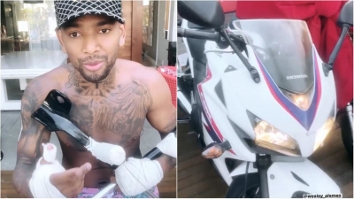 Após sofrer acidente, Nego do Borel anuncia sorteio de suas motos