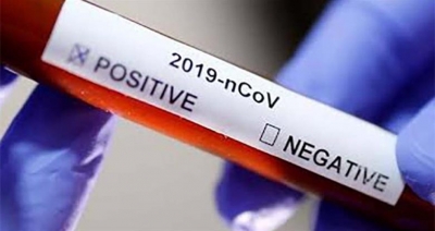 Covid-19: região de Marília chega a 43 mortes e 1.720 casos