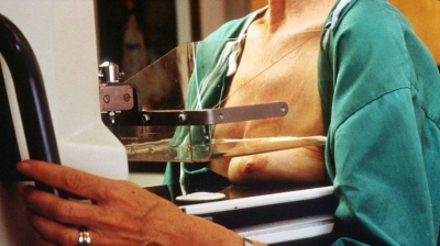 Mamografia é a melhor forma de salvar vidas