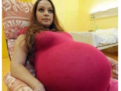 Uma mulher é atendida por 40 médicos para um parto que acontece uma vez a cada 480 anos