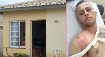 Família tenta vender até a casa para pagar cirurgia de rapaz em Marília