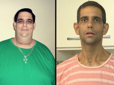 Apenas com dieta e exercícios, homem perde 217kg.