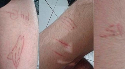 MPF apura vídeos que incentivam jovem a se mutilar