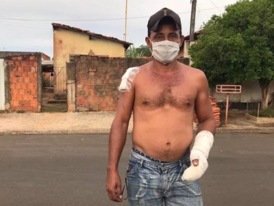 Vizinho estoura grade de janela para resgatar bebê de casa pegando fogo: 