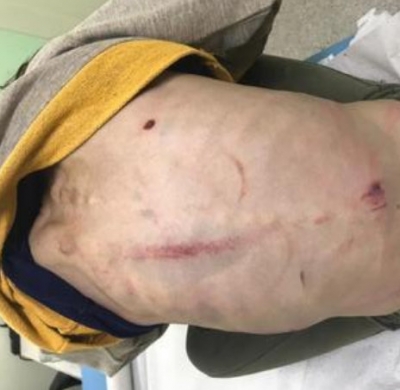 Mulher é investigada por torturar e agredir filha de 7 anos. Menina não comia há dias