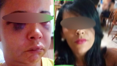 Após novas agressões, família denuncia violência doméstica contra mulher