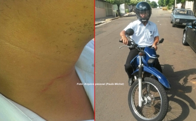 Motociclista escapa da morte ao ter pescoço atingido por linha cerol