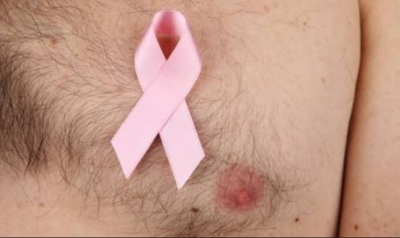 Apesar de raro, câncer de mama também pode afetar homens