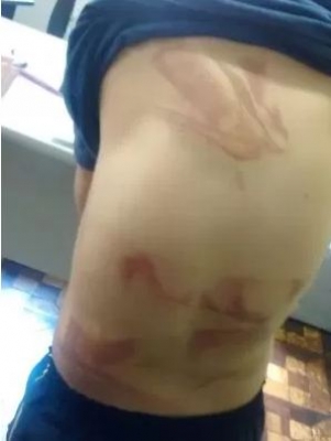 Polícia investiga agressão de pai a menino de 7 anos