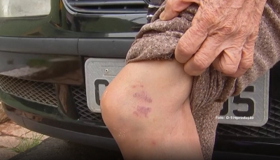 Criminosos se passar por instaladores de TV e agridem idosa durante assalto em Marília