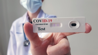 Procon fiscaliza preços abusivos de testes de covid-19