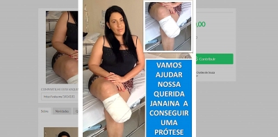 Após amputação, mulher faz campanha em Marília para conseguir prótese 