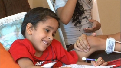 Garoto que foi separado do irmão siamês já frequenta escola