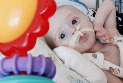 Avó pede ajuda para tratamento do neto que nasceu com Down e problemas no coração