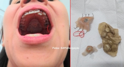 Mulher é detida tentando entrar em penitenciária com equipamentos eletrônicos nos dentes