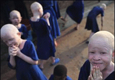 Caçados como animais: albinos vivem sob ameaça constante