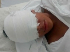 Garoto sofre queimaduras                          ao fazer bomba com receita da internet