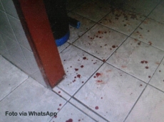 Assaltante fere vítima                                     e é preso pela PM