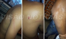 EXCLUSIVO: Jovem é agredido com barra de ferro na zona norte
